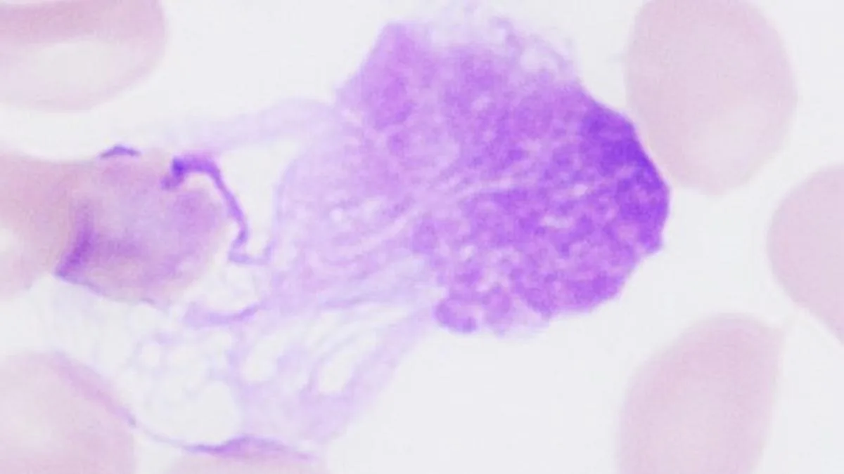 All you need to know about: Chronic Lymphocytic Leukemia (CLL)