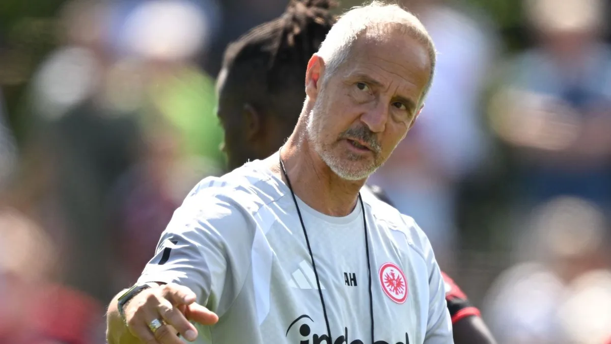 Bundesliga: Trotz vieler Baustellen: Hütter freut sich auf Comeback