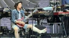 James Bay performs with broken ankle at Bon Jovi gig