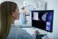Sanidad no prevé que la aprobación definitiva de la ampliación del cribado de cáncer de mama antes del 29 de noviembre