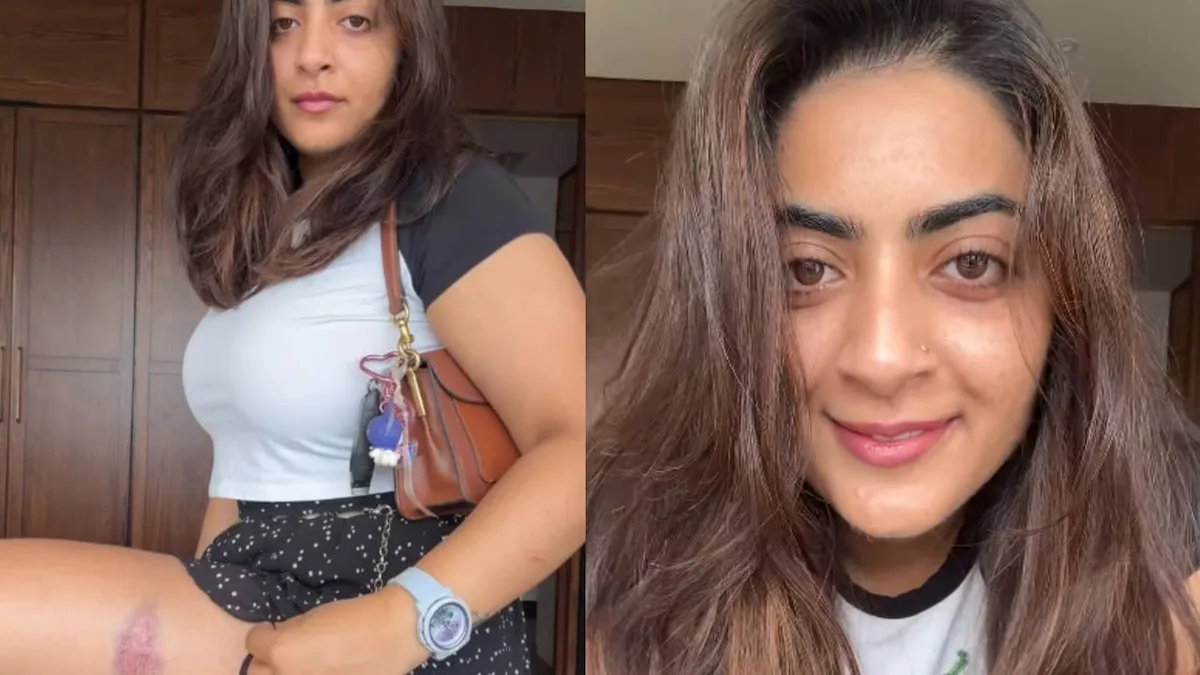 Aamir Khan's Niece Zayn Marie Shares Video Of Injury Marks After Detention During CJP Protest In Mumbai