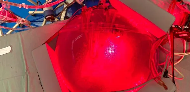 ‘Gêmeo digital’ do tórax simula aplicação de luz para tratamento de pneumonias
