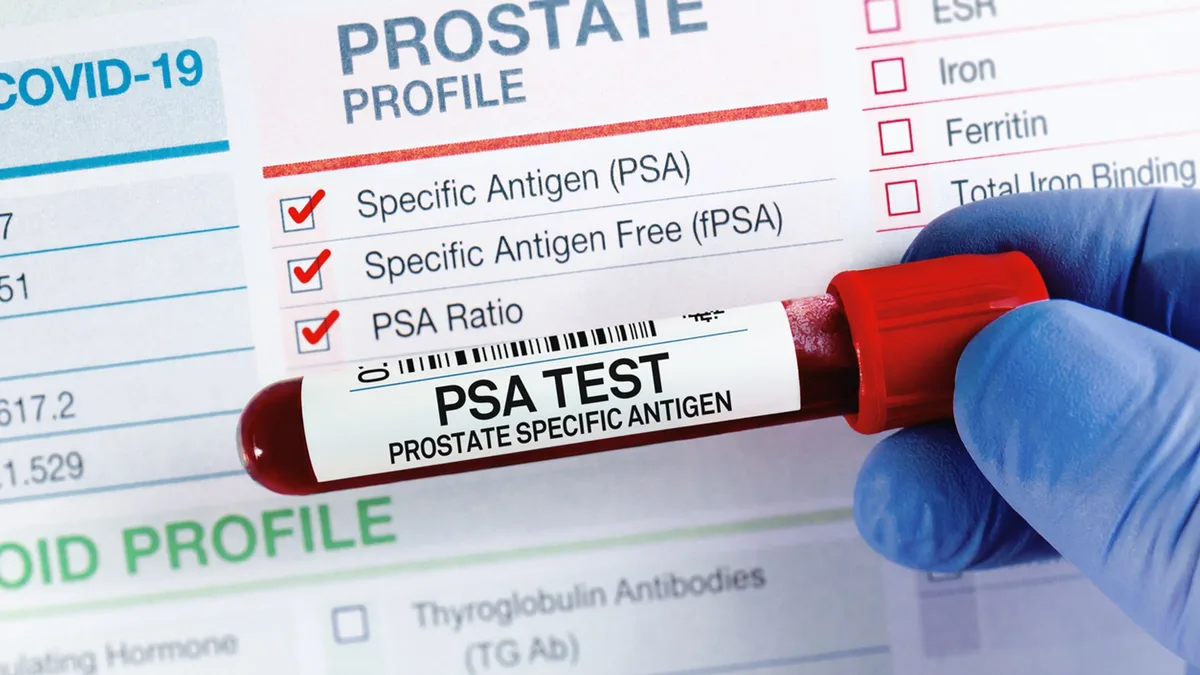 Prostate cancer cases surge in UK - as charity warns against 'myths'