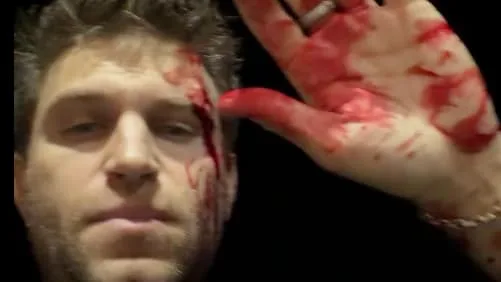 Sie kamen mit Waffe und Messer - „Pretty Little Liars“-Star brutal überfallen