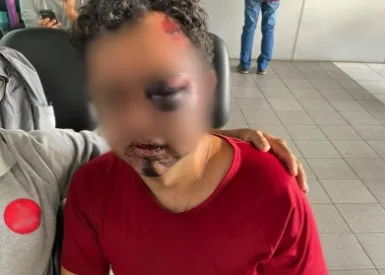 Trio usa “boa-noite, Cinderela”, espanca homem e rouba carro