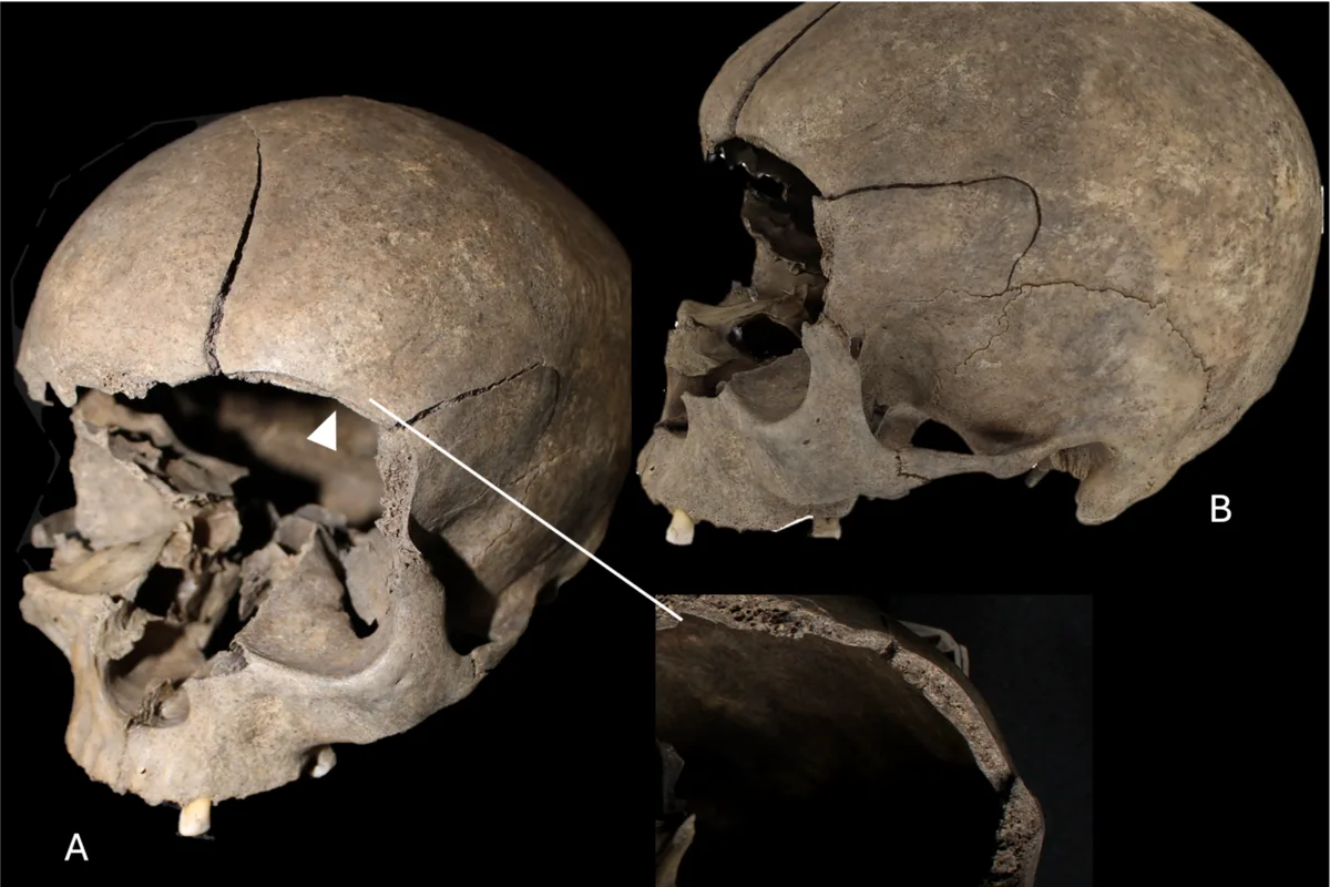 Iron and Viking Age Scandinavians Kept Their Victims’ Bones Around the House