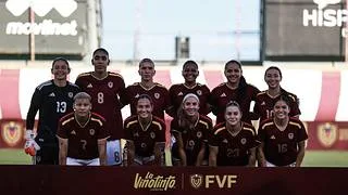 ¡Baja sensible! La Vinotinto Femenina pierde a una de sus figuras para el repechaje