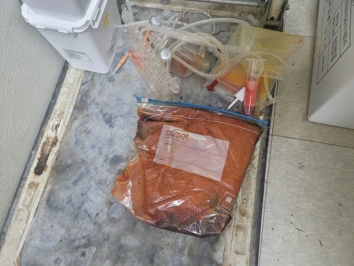 지방흡입 후 남은 ‘지방’·‘혈액’을 개수대에?…성형외과 등 25곳 적발