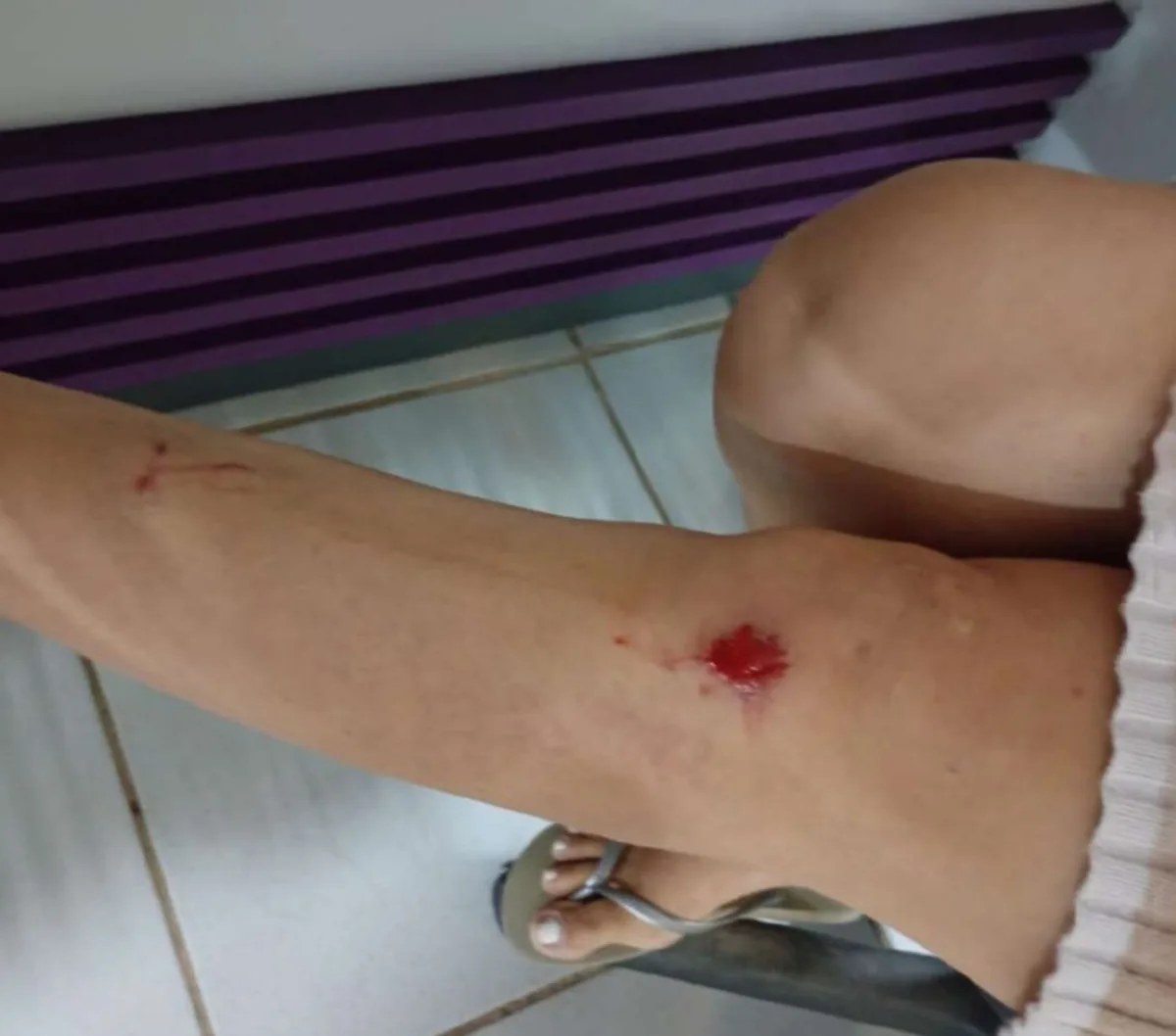 Tenente-coronel do Exército é suspeito de agredir companheira em Boa Vista