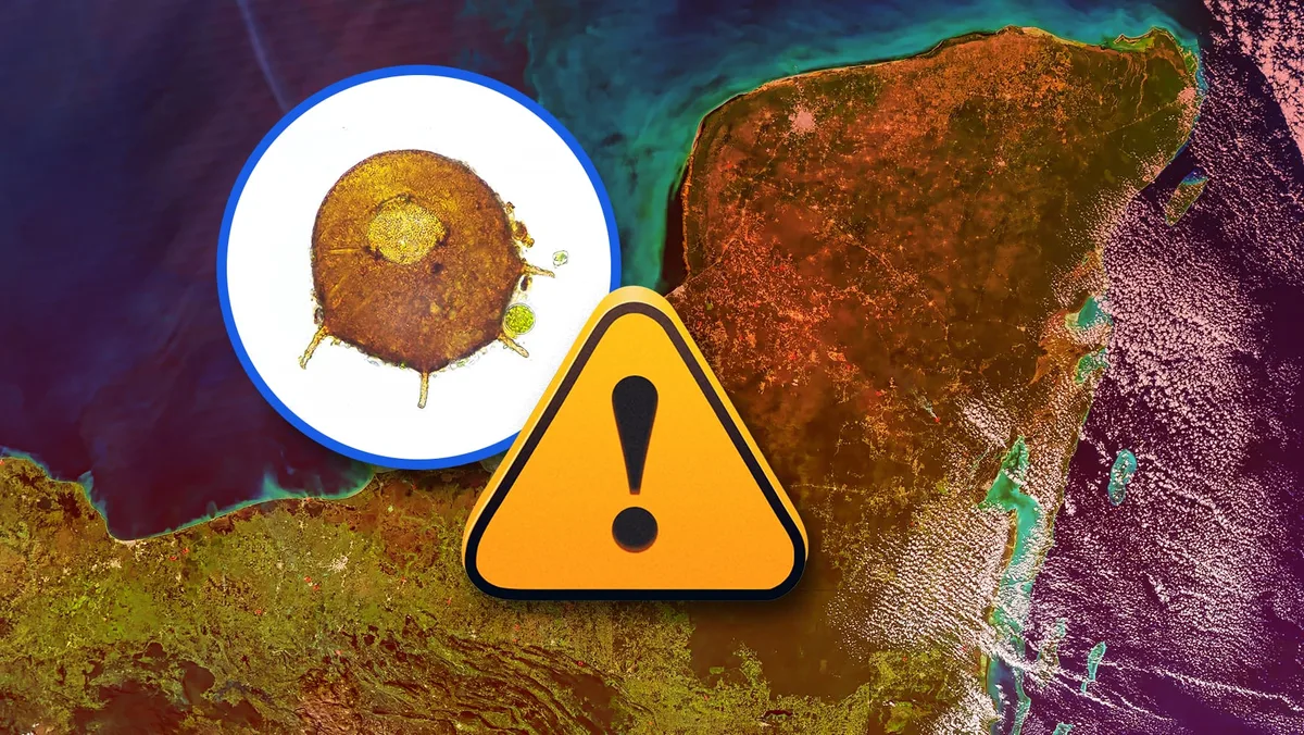 ‘Tiene letalidad mayor al 97%’: Salud de Yucatán alerta por ameba ‘comecerebros’ en lagos artificiales