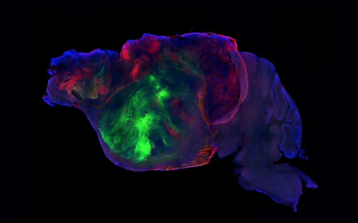 Des chercheurs ont connecté du tissu humain dans le cerveau de souris : ce qui s’est produit ensuite est inédit !