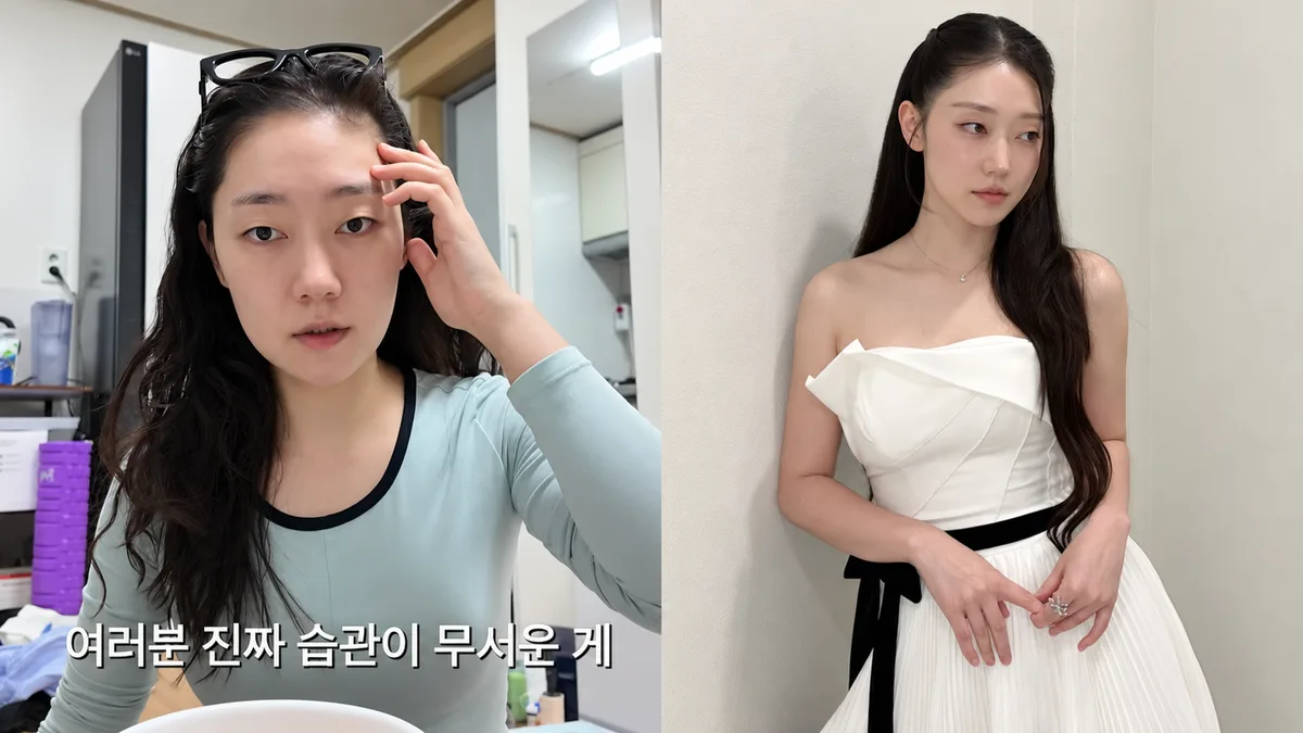 박경혜 “5일 만에 2kg 뺐다”…드레스 위해 바레·달걀 식단, 단기 감량 괜찮을까