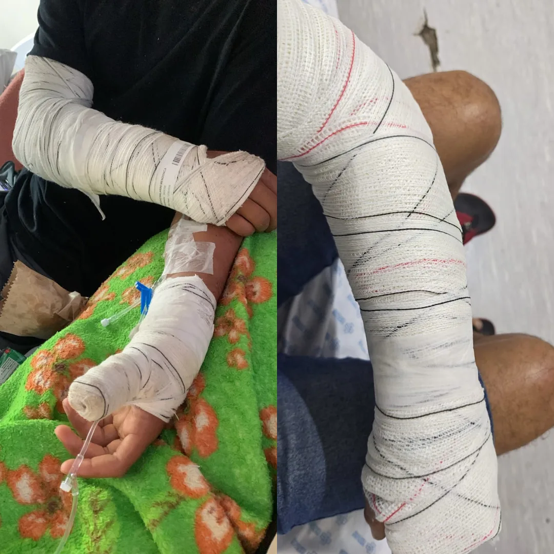 Vítimas de acidente relatam espera de quase 2 semanas por cirurgia na Santa Casa