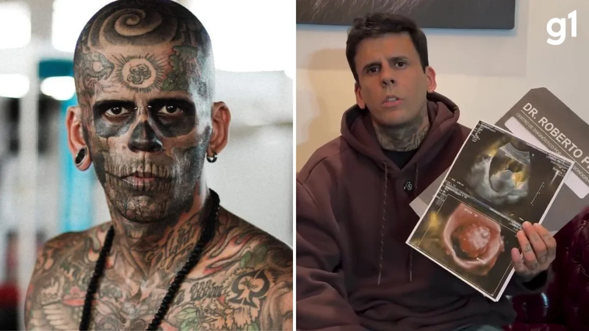 'Melhor estar vivo', diz homem mais tatuado do Brasil após saber que terá que retirar bexiga por conta de câncer