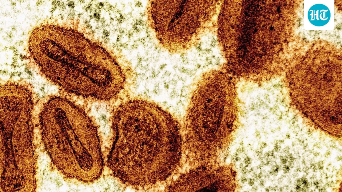 Guinea-Bissau reports first mpox outbreak, half of suspected cases are children