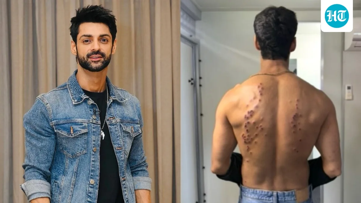 Karan Wahi recalls the impact of controversial pellet gun task on Khatron Ke Khiladi 15: ‘My mind went numb’