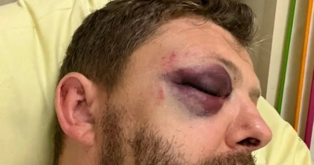 Paris. « Il m'a dit je vais te tuer » : le témoignage glaçant du policier agressé dans le quartier du Marais