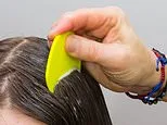 How to survive Britain's head lice plague as experts warn the bugs are becoming RESISTANT to common treatments. Here's what REALLY works to banish them for good