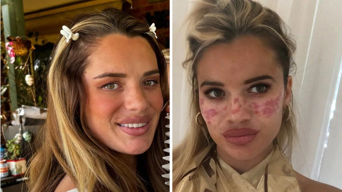 Influencer and TV personality Tilly Whitfield launches own line of tattoo freckle products after DIY horror