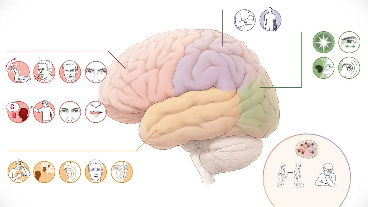 Infografik: Déjà-vus, Absencen – die wenig bekannten Symptome der Epilepsie