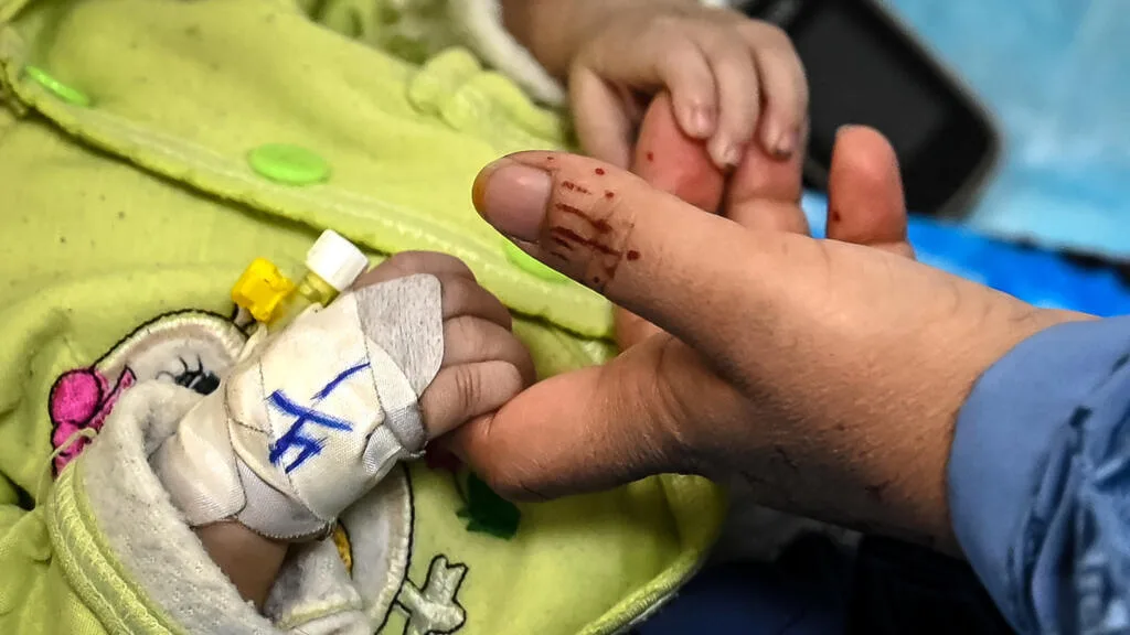 Afghanistan : un million d'enfants en danger de mort à cause de la malnutrition, selon l'Unicef