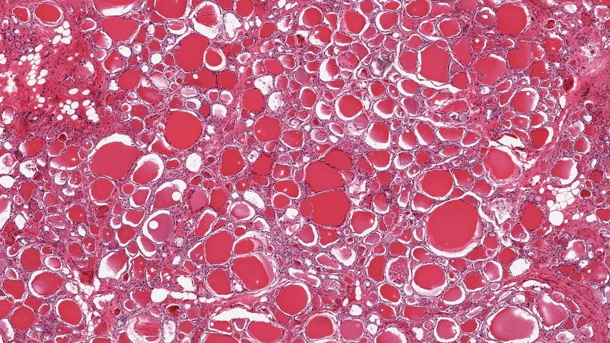Herz, Lunge, Gehirn – jedes Organ altert in eigenem Tempo. Eine „Nature”-Studie mit fast 26.000 Gewebeaufnahmen zeigt, wie groß die Unterschiede sind.