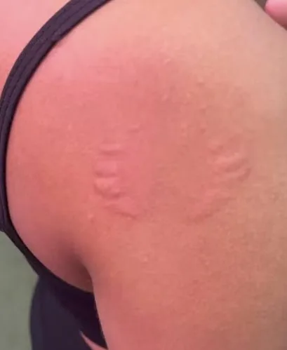 Mulher denuncia instrutor de academia após ser agarrada e mordida em treino; câmeras de segurança flagram a ação e empresa se manifesta Mulher denuncia instrutor de academia após ser agarrada e mordida em treino; câmeras de segurança flagram a ação e empresa se manifesta