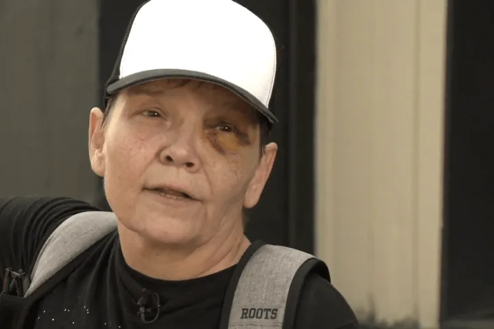 Vancouver woman says she’s disappointed random assault suspect already released