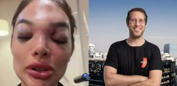 Mulher de empresário preso por violência volta pra casa em SP: 'Assustador'