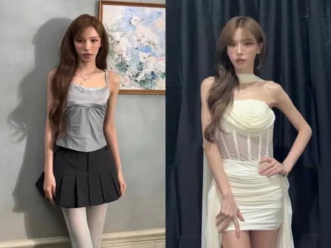 웬디, '뼈말라' 근황에 쏟아지는 우려.."건강이 우선" 걱정·응원 쇄도[핫피플]