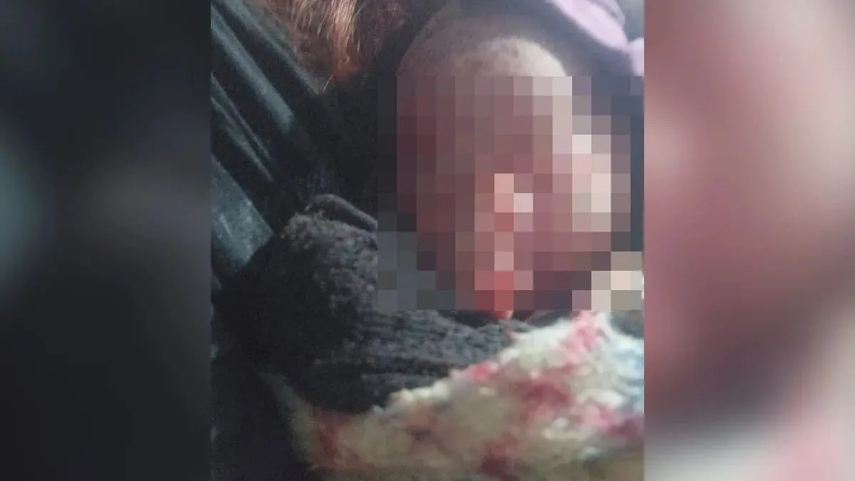 ‘Tá com cordão umbilical ainda’: Mulher pensou que era um gato, mas encontrou bebê recém-nascida chorando dentro de saco de lixo no PR