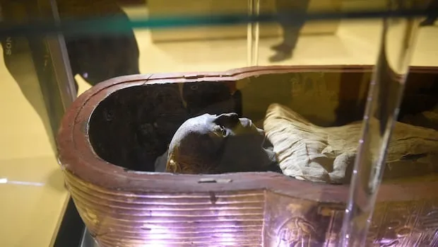 People are trading mummified human remains online. Some scientists say that may be bad for their health