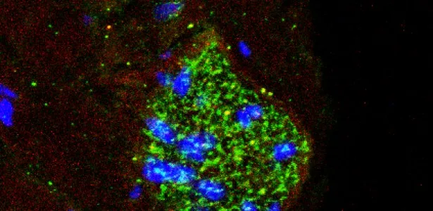 Estrutura que controla a pressão arterial também age como ‘radar’ de inflamação