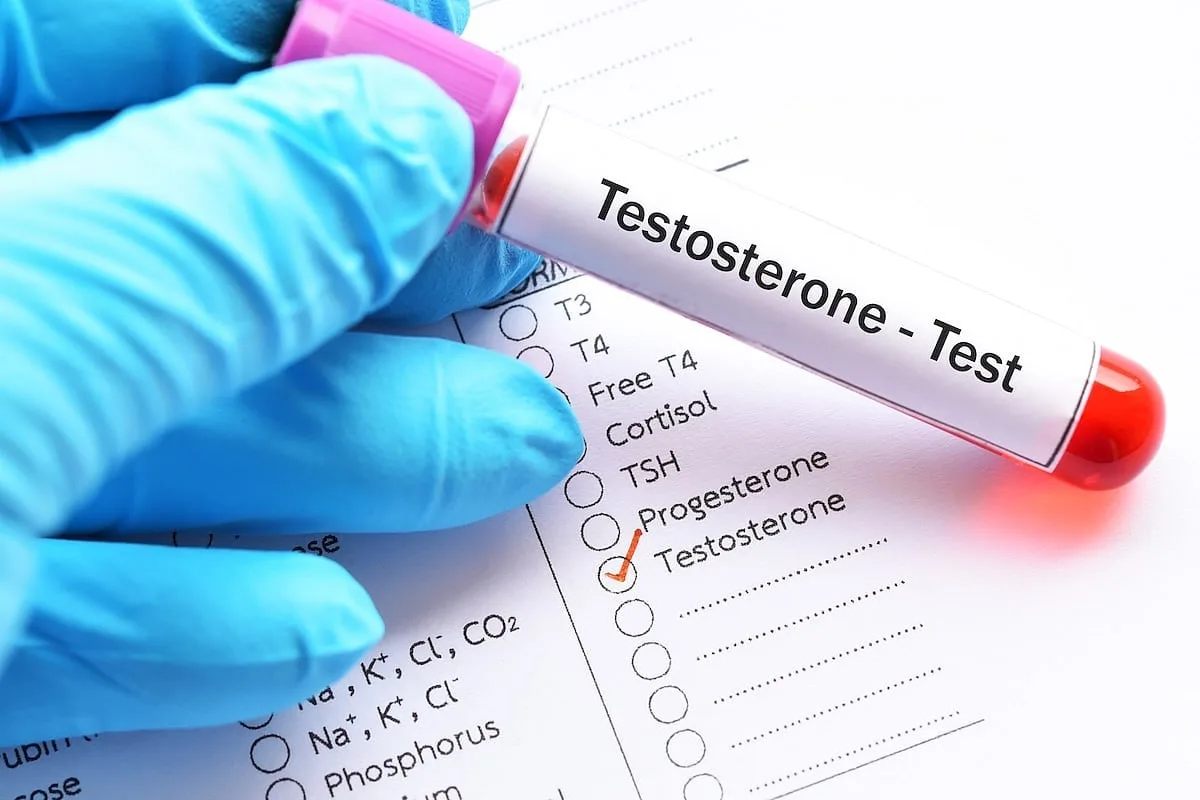 La testosterona alta aumenta el riesgo de trastorno del ritmo cardíaco, según una revisión