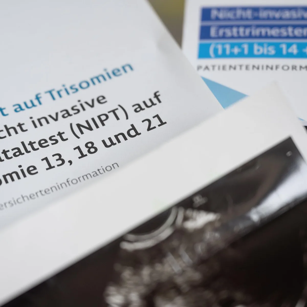 Bundestag - Verordnung vorgeburtlicher Bluttests soll überprüft werden
