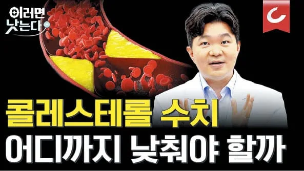 심혈관질환 주범, LDL 콜레스테롤 확 낮춰야