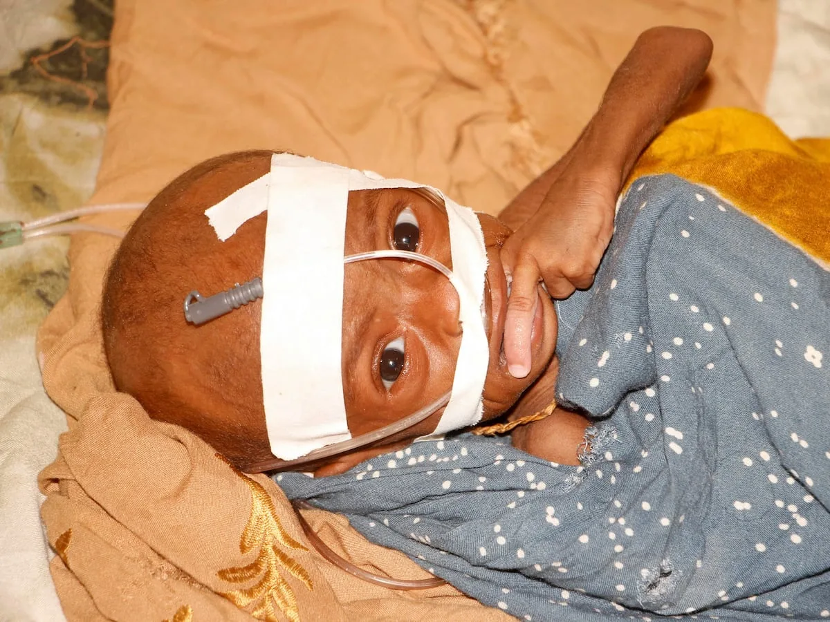 What to know about USAID and deadly effect of US foreign aid cuts