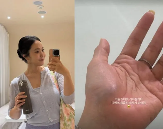 박지윤, 부상 소식 전했다 “다리에 힘 풀려 대차게 넘어짐”