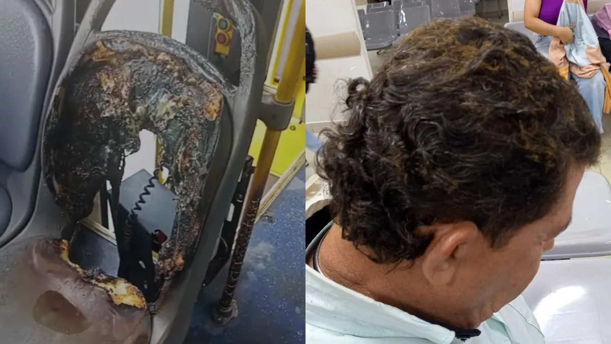 Ônibus é incendiado por criminosos e motorista sofre queimaduras em Olinda; VÍDEO