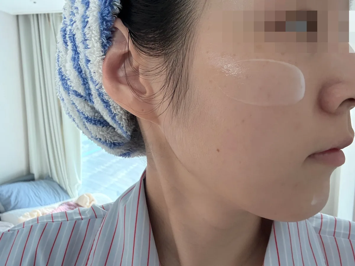주름 수 347개→54개 임상, 서울대 보톡스 세럼을 기자가 직접 바른 후 느낀 변화