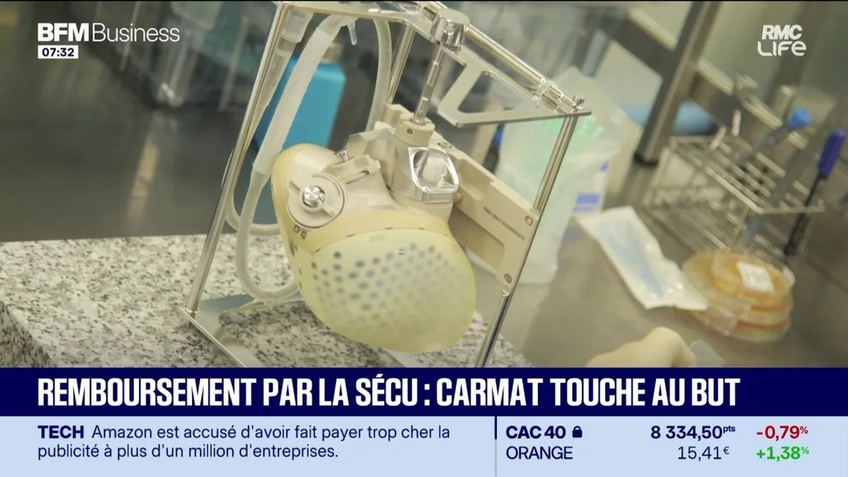 Remboursement par la sécu : Carmat touche au but