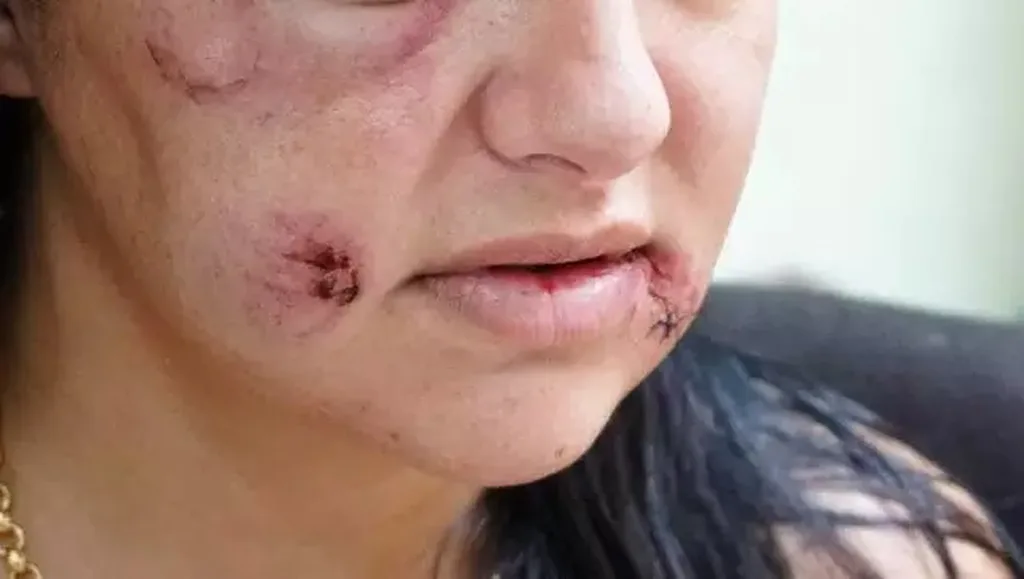 Feminicídio vai entrar na lista internacional de doenças da OMS