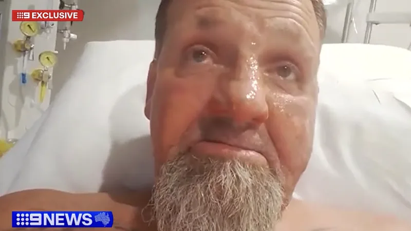 Patient suffers burns in alleged petrol attack inside major Sydney hospital