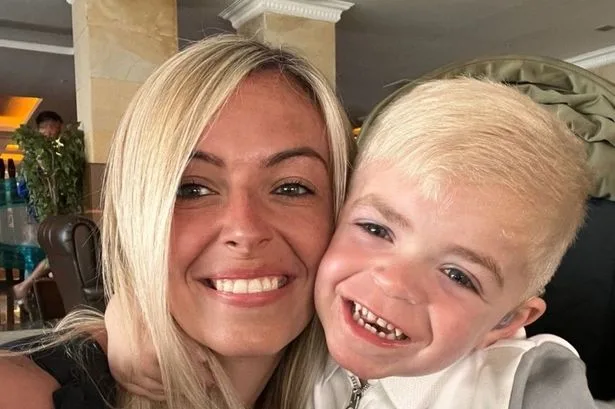 Boy, 5, diagnosed with 'childhood dementia' Sanfilippo syndrome after specialist saw symptom in his face