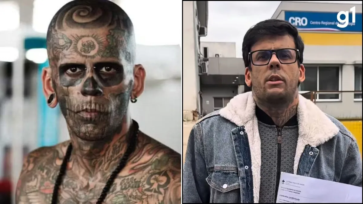 Cirurgia do 'homem mais tatuado do Brasil' será decisiva para definir gravidade de tumor na bexiga