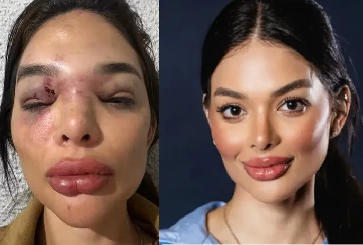 O que se sabe até agora sobre o caso de agressão de dentista por empresário da Faria Lima