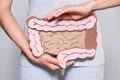 Un estudio cuestiona el supuesto beneficio del sobrepeso en la supervivencia del cáncer colorrectal