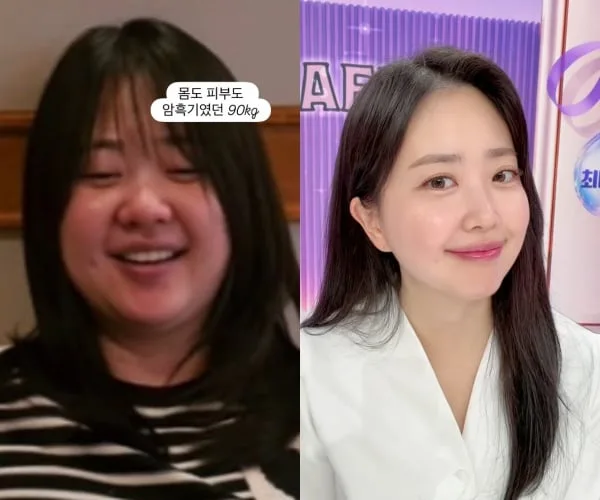 ‘박수홍 아내’ 김다예, 같은 사람 맞아? 39kg 감량했는데 90kg 시절 또 소환[핫피플]