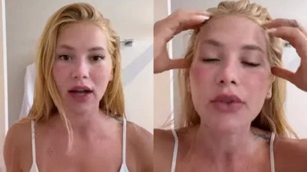 Virginia surpreende seguidores ao aparecer com rosto inchado e explica motivo; assista Virginia surpreende seguidores ao aparecer com rosto inchado e explica motivo; assista