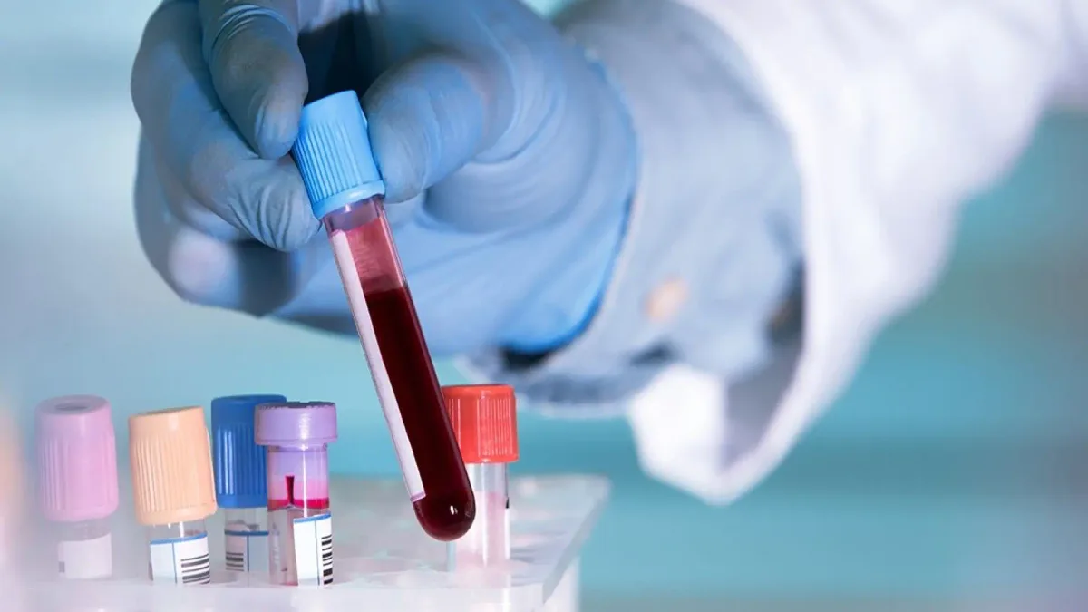 Desarrollan un análisis de sangre que podría facilitar la detección temprana en el regreso del cáncer de mama